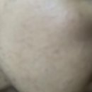 [안산] 안산 섬세한 피부관리는 #아이이뽀&amp;테오트리 에서!