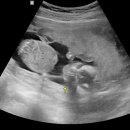 삼성미래여성병원 이미지