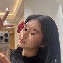 김한의원 | 김포피부과 김포한의원 리프팅 고민하다 받은 올리지오 슈링크 후기