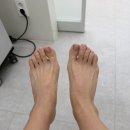 글램네일내성발톱무좀발톱발각질 디에고푸스강남점 | 강남 문제성 발톱 관리 전문 하이푸스 포쉬네일 가로수길점, 발각질관리 후기 🦶 [신사역 발관리...