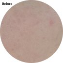 ASMC | 피부건조증 탈출 환절기에도 윤기나는 피부 셀프 관리법