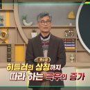이슈 헤럴드경제