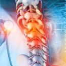 이노메디 이미지