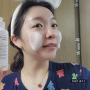 초이스 인셀덤 이미지