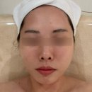 신월동165 | 신월동피부관리 비비에스테틱 인퓨즈루미셀 케어 후기