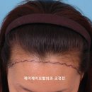 제이제이서연외과의원 네이버블로그