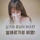 에스아산이비인후과의원 이미지