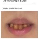 TNF 이미지