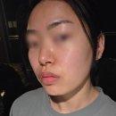 서울프랑스학교 | 바디사운드스킨 반포] 반포동 피부관리 경락 관리...어깨 뭉침과 윤곽 고민 한 번에 해결한 솔직 후기