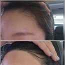 희헤어라인 이미지