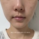 에이치플러스 | 홈모드 써마 리프트 내돈내산 8주 후기 (+홈모드 스킨부스터 엑소샷 에이치이 플러스 후기)