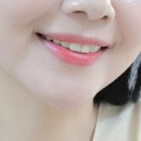 올리브영 치약 추천 덴티스테 시트러스후레쉬 불소 치약으로 충치 예방