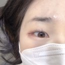 리지브로우