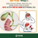 윗배 통증 원인 담석증 증상 및 치료 이미지