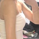 바디리핏 | 신촌역 피부과 지방분해주사, 튠바디+밀리핏:) 팔뚝 1회차 내돈내산 후기!