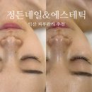 오늘:정든곳 | 익산 피부관리 정든 에스테틱에서 모공 스파 관리 솔직후기 ( +데콜테마사지 )