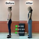 자세 개선 필라테스 A | [도농필라테스] 틀어진 자세, 필라테스로 바뀔까요?🙋‍♀️