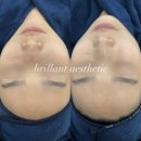 브리앙뜨에스테틱