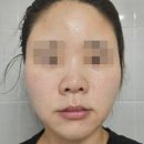 (주)디자인포유 | 비포유 진생마스크 &amp; 비포유 진생미스트, 피부재생템 추천!