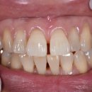 세온 치과기공소 이미지