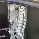 치유간증 올립니다^^ 이미지
