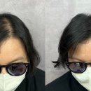 리라헤어라인