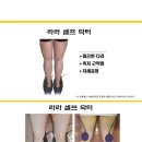 라라테라피
