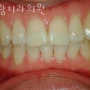 세광치과의원 네이버블로그