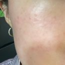 터미널신둔홈(32717) | [이천 토탈뷰티샵 아이유] 스킨플래닝 솔직후기