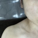 세포삼거리 | 보라매 피부관리 디또뷰티 보라매점 트러블 피부 관리 (플라즈마) 후기