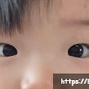 류원열안과의원 네이버블로그