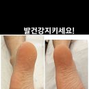 출산전 준비하세요 발관리 각질관리 이미지