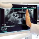 이도메디 | 코웰메디 잇몸뼈이식 국산 임플란트 수술 후기 20대 및 노인 임플란트 추천