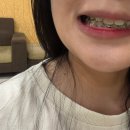 결혼전야