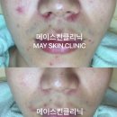 메이 스킨클리닉