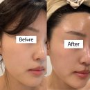 개꿀샵 | 수유역피부관리샵 하로스파 얼굴 탄력 보습 관리 후기