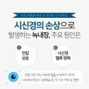 세종이안과의원 이미지