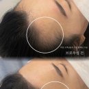 후후브로 이미지