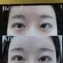 동양개발(주) | 원장님이 직접 상담하고 시술하는 강남 투엠 메이크업, 무통증 눈썹 반영구 통해서 비대칭 교정한 후기!