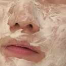 [내돈내산] 편평사마귀 제거 &amp; 피지선증식증 아그네스 한의원 후기 (+사진)