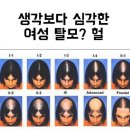 인셀덤(v)