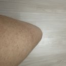 메디스코 | [공지] <내돈내산> 메디스코 해초필링 필리브필링 셀프 홈케어 후기