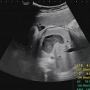 참여성병원 이미지