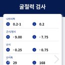 멍때려 | 렌즈삽입술(EVO ICL 렌즈) 후기(대구 난초꽃피다)