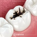 미미고강동 이미지