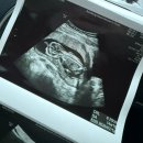 분당서울여성의원 이미지