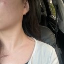 대구 시지 피부관리 산디야 에스테틱 청담디톡스 후기