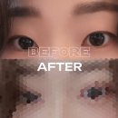 제나성형외과의원 | [부산성형외과]제나성형외과 / 비절개 쌍커풀 매몰 뒤트임 밑트임 앞트임 가격 내돈내산 후기(1)