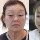 이혜정 스킨 | 빅마마 이혜정 "200% 만족" 피부과 미용 시술 실리프팅 스킨 보톡스 후기