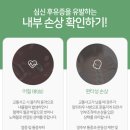 언제나한의원 네이버블로그